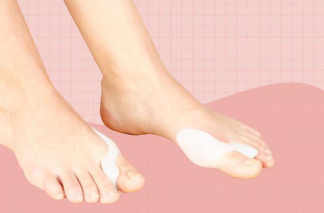 How to treat bunions, few tips from insoles manufacturer
