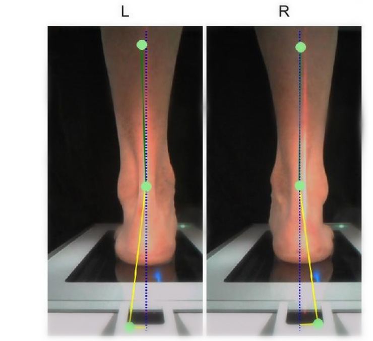 Biomechanical Research